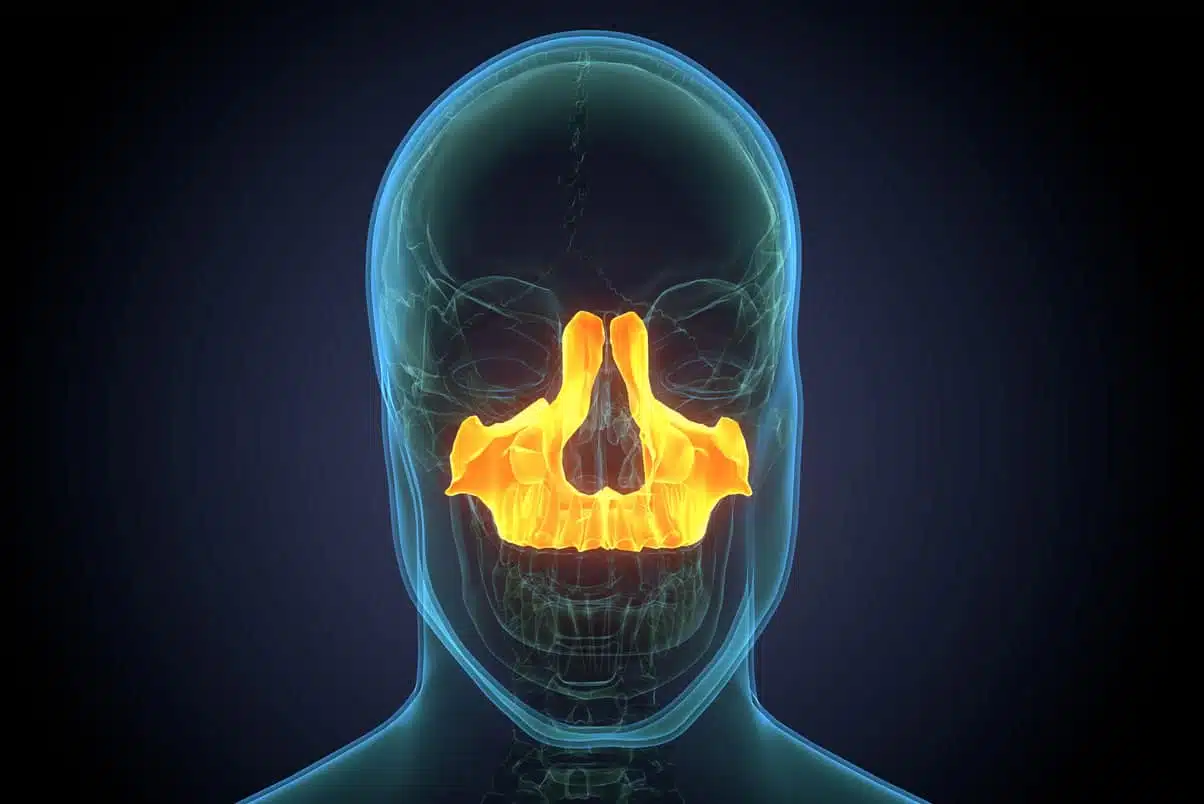 Maxillaire du visage | Dr Jacques Saboye