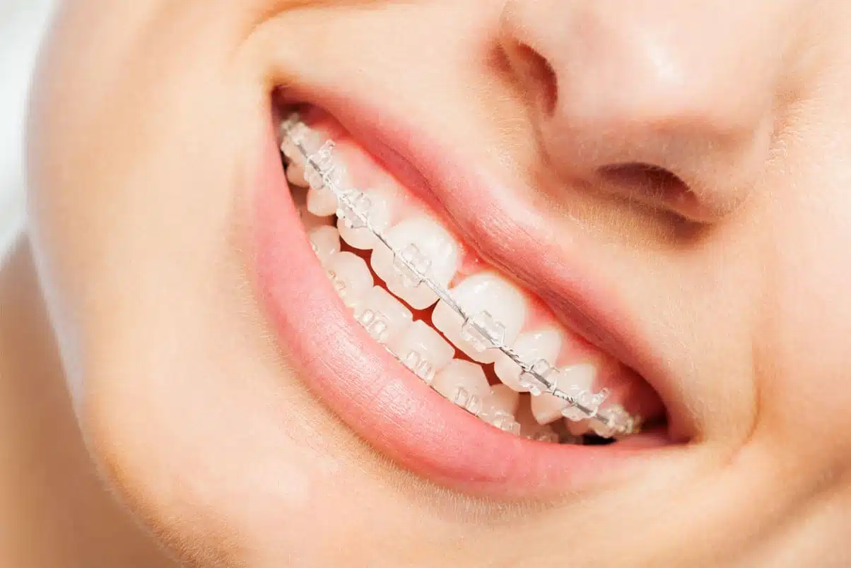 Orthodontie : la croissance du visage | Dr Jacques Saboye