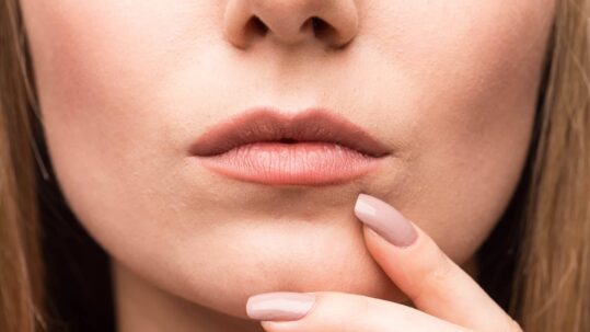 Comment redonner du volume à mes lèvres ? | Dr Saboye | Toulouse